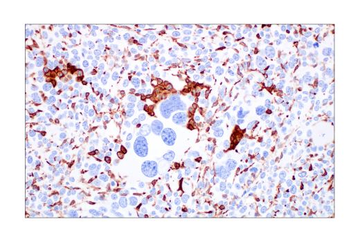 undefined Image 58: Mouse Reactive M1 vs M2 Macrophage IHC Antibody Sampler Kit