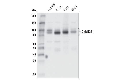 Western Blotting Image 1: DNMT3B (E8A8A) XP<sup>®</sup> Rabbit mAb