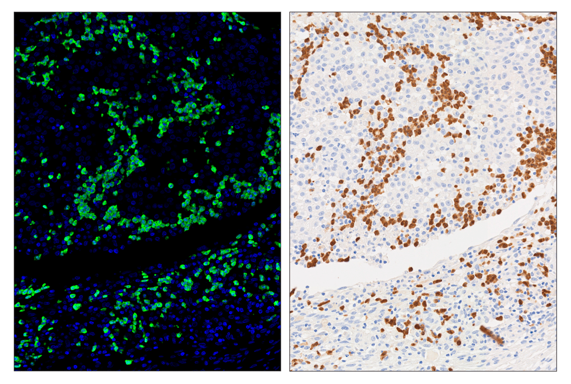 Immunohistochemistry Image 5: Arginase-1 (D4E3M) & CO-0075-750 SignalStar<sup>™</sup> Oligo-Antibody Pair