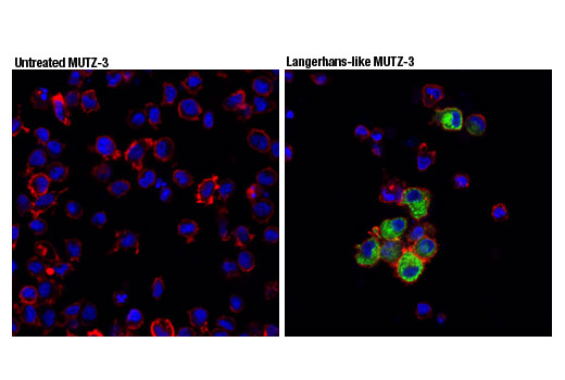 Immunofluorescence Image 1: Langerin (D9H7R) XP<sup>®</sup> Rabbit mAb (BSA and Azide Free)