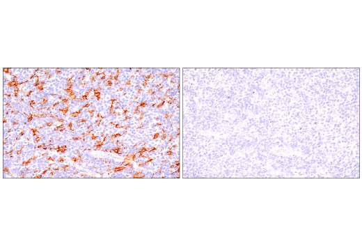 Immunohistochemistry Image 4: GM-CSF Receptor α (E8Z3S) Rabbit mAb