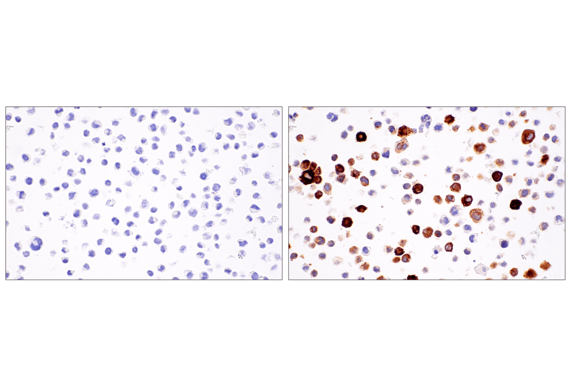 Immunohistochemistry Image 1: IL-8 (E5F5Q) XP<sup>®</sup> Rabbit mAb (BSA and Azide Free)