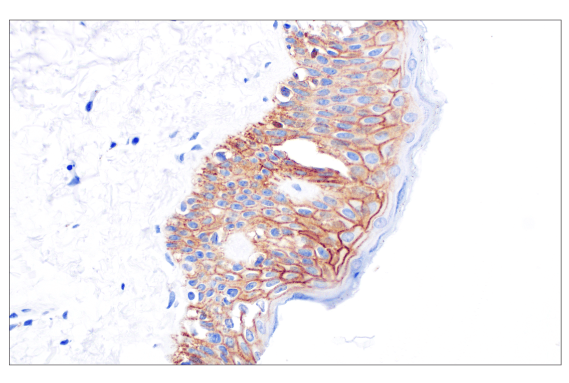 Immunohistochemistry Image 8: CD44 v5 (C44Mab-3) Mouse mAb