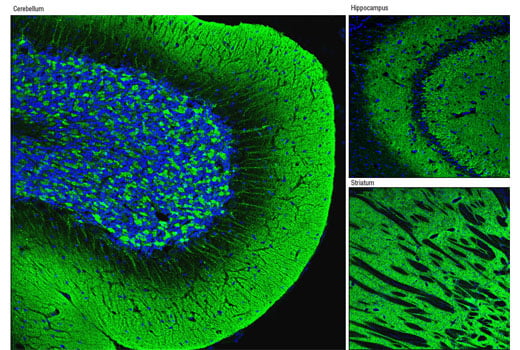 Immunofluorescence Image 1: α-Synuclein (D37A6) Rabbit mAb
