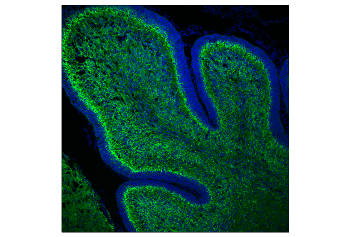 Immunofluorescence Image 1: Doublecortin (F6K9E) Rabbit mAb (BSA and Azide Free)