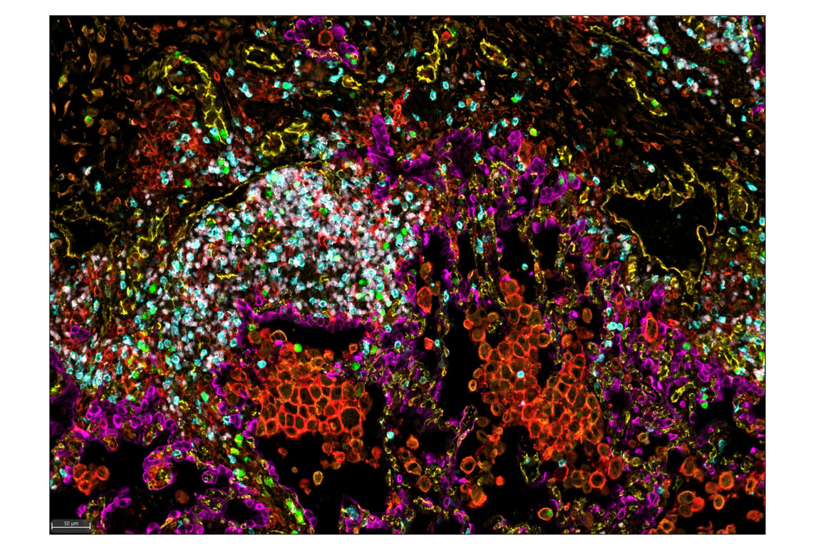 Immunohistochemistry Image 1: Ki-67 (8D5) & CO-0014-647 SignalStar<sup>™</sup> Oligo-Antibody Pair