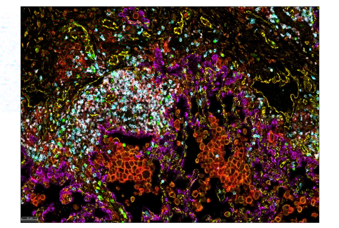 Immunohistochemistry Image 1: Ki-67 (8D5) & CO-0014-647 SignalStar™ Oligo-Antibody Pair
