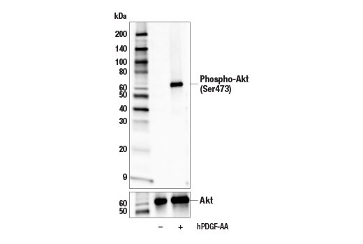 Western Blotting Image 3: Phospho-Akt (Ser473) (E4U3U) Mouse mAb