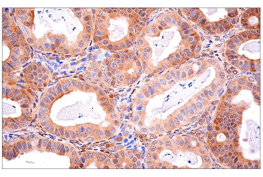 Immunohistochemistry Image 9: SOD1 (E4G1H) XP<sup>®</sup> Rabbit mAb