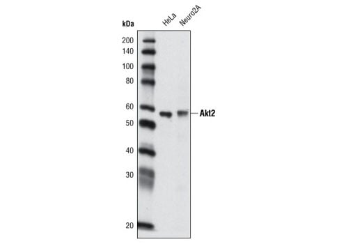 Western Blotting Image 2: Akt2 (L79B2) Mouse mAb