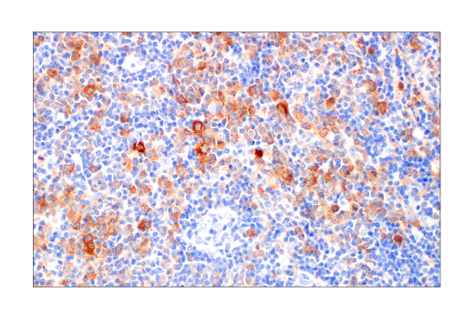 Immunohistochemistry Image 2: Asparagine Synthetase (E6C2C) XP<sup>®</sup> Rabbit mAb (BSA and Azide Free)