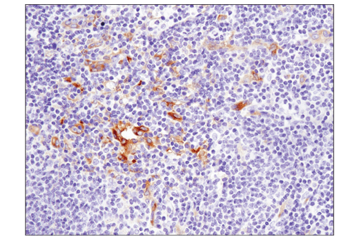 Immunohistochemistry Image 5: IFIT1 (D2X9Z) Rabbit mAb