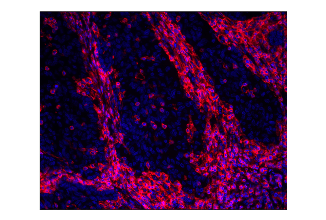 Immunohistochemistry Image 1: CD45 (Intracellular Domain) (D9M8I) XP<sup>®</sup> Rabbit mAb (Alexa Fluor<sup>®</sup> 647 Conjugate)