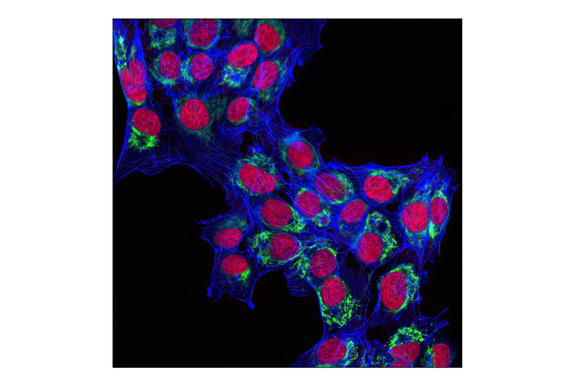 Immunofluorescence Image 1: DyLight 650 Phalloidin