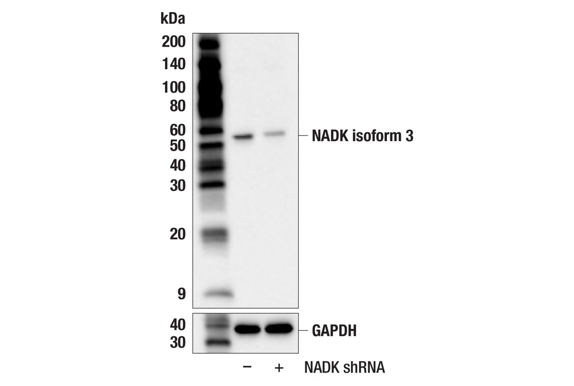 Western Blotting Image 4: NADK Isoform 3 (F5E2T) Rabbit mAb