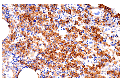 Immunohistochemistry Image 1: CD38 (E7Z8C) XP<sup>®</sup> Rabbit mAb