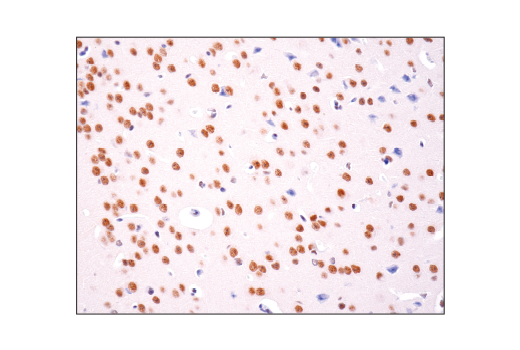 Immunohistochemistry Image 3: HAUSP (D17C6) XP<sup>®</sup> Rabbit mAb (BSA and Azide Free)