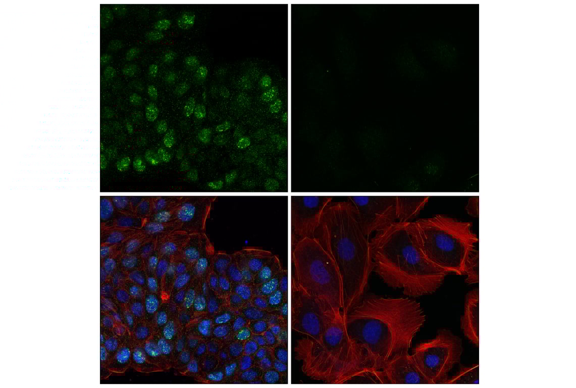 Immunofluorescence Image 1: BRCA1 (E5S9G) Rabbit mAb