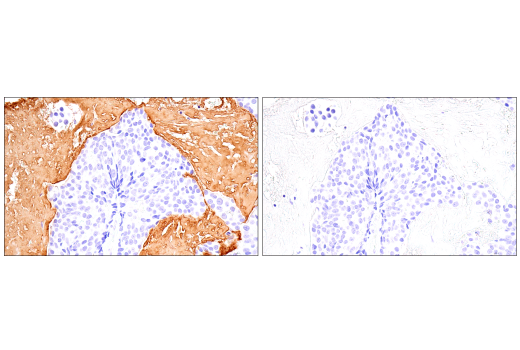 Immunohistochemistry Image 5: Fibrinogen gamma chain (E1U3Z) XP<sup>®</sup> Rabbit mAb