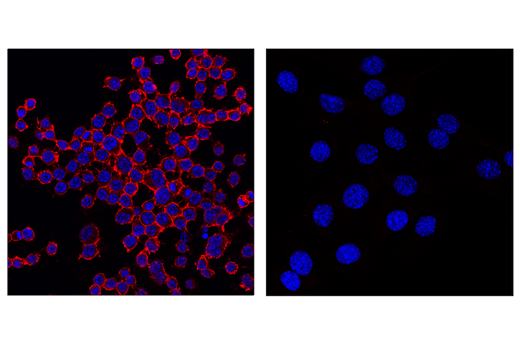 Immunofluorescence Image 1: CD45 (D3F8Q) Rabbit mAb (Alexa Fluor<sup>®</sup> 594 Conjugate)