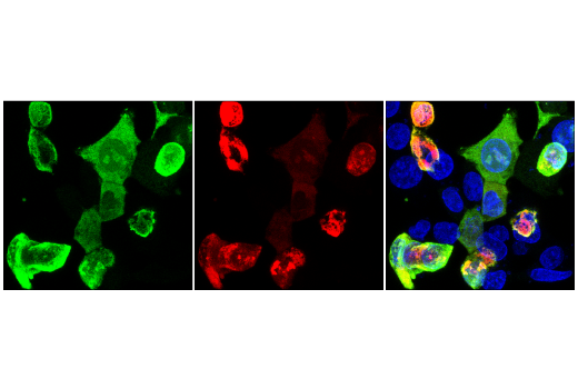 Immunofluorescence Image 1: Cas9 (7A9-3A3) Mouse mAb (Alexa Fluor<sup>®</sup> 594 Conjugate)