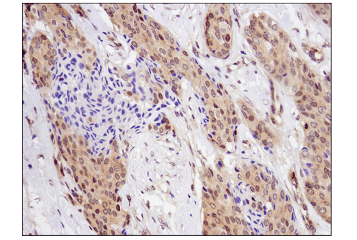 Immunohistochemistry Image 2: SMAD4 (D3R4N) XP<sup>®</sup> Rabbit mAb