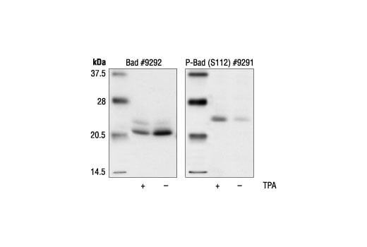 Western Blotting Image 3: Bad Antibody