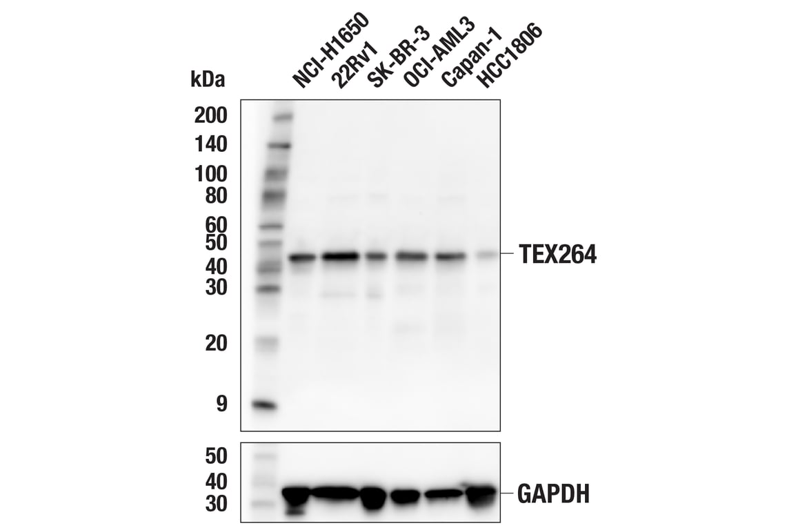 Western Blotting Image 1: TEX264 (E2J3J) Rabbit mAb
