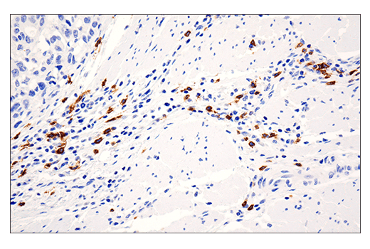 Immunohistochemistry Image 2: CD20 (E7B7T) XP<sup>®</sup> Rabbit mAb