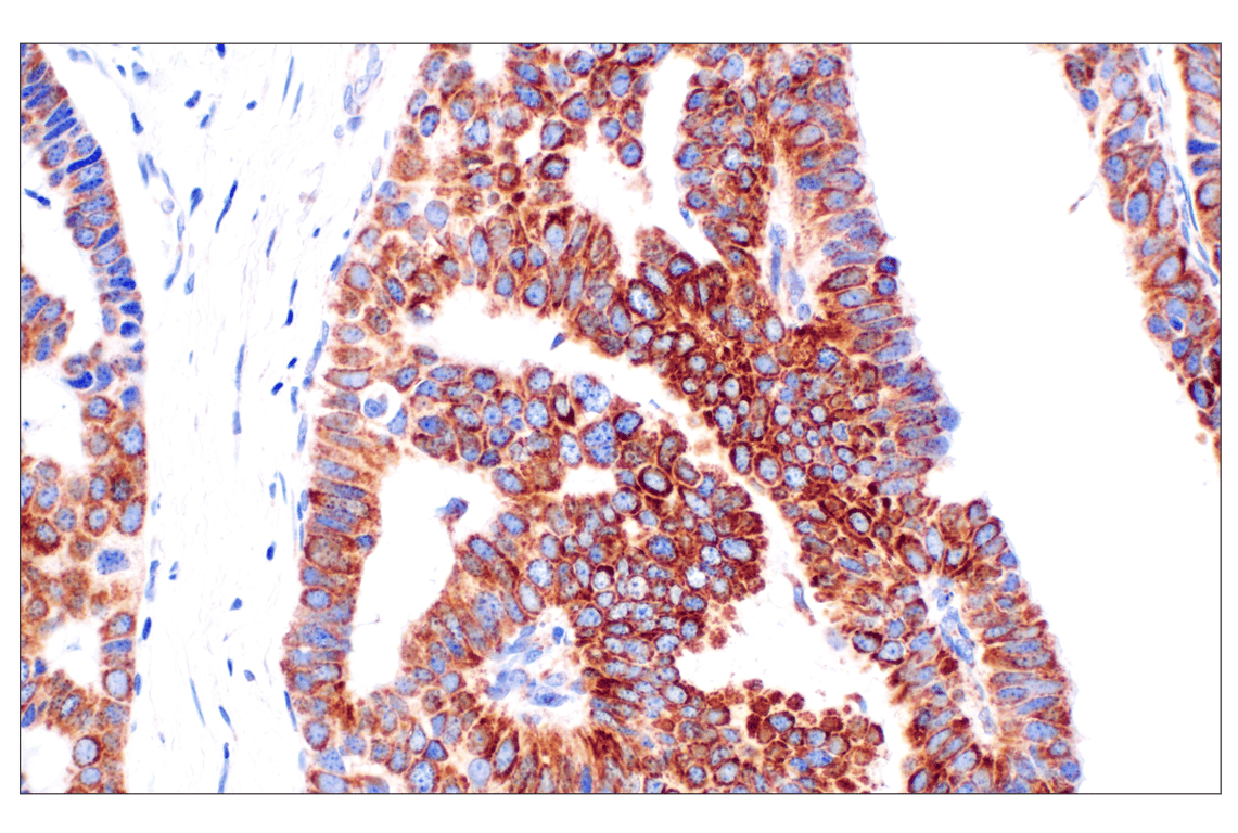 undefined Image 35: Cell Fractionation Antibody Sampler Kit