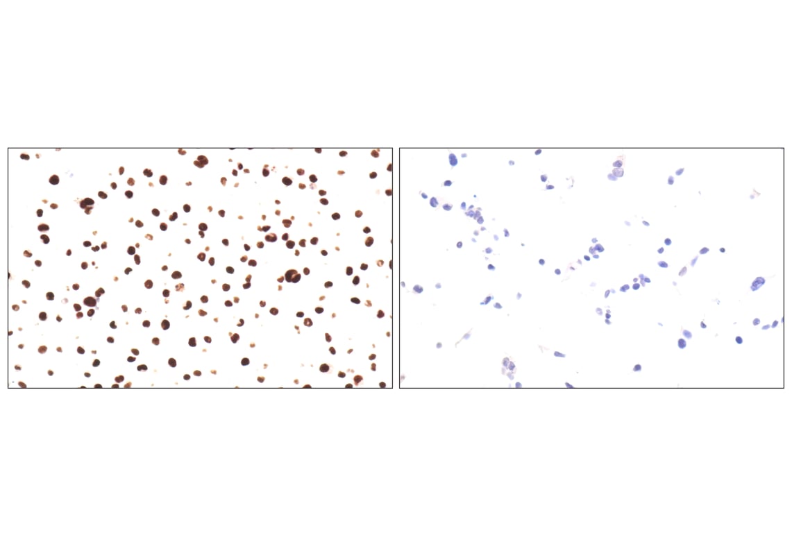 Immunohistochemistry Image 12: BATF3 (E3F3L) Rabbit mAb
