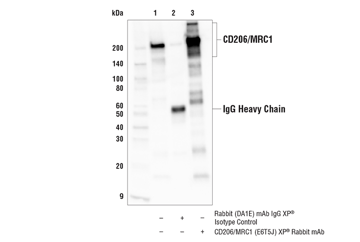 undefined Image 12: Mouse Reactive M1 vs M2 Macrophage IHC Antibody Sampler Kit
