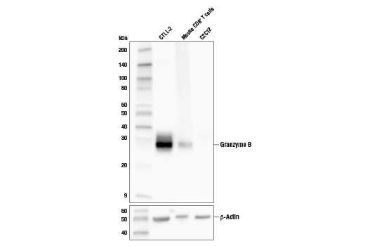 undefined Image 19: Human Exhausted CD8<sup>+</sup> T Cell IHC Antibody Sampler Kit