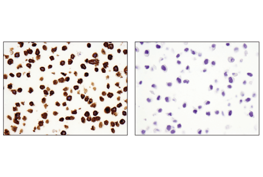 Immunohistochemistry Image 2: TNFRSF8/CD30 (E4L4I) XP<sup>®</sup> Rabbit mAb (BSA and Azide Free)