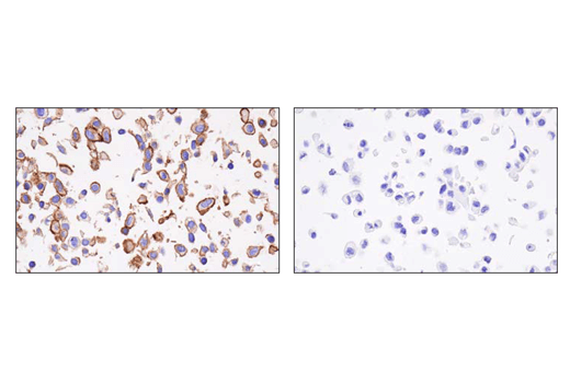 Immunohistochemistry Image 2: CD200 (E5I9V) XP<sup>®</sup> Rabbit mAb (BSA and Azide Free)