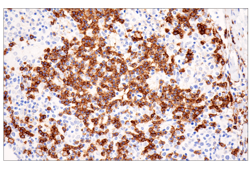 Immunohistochemistry Image 4: CD20 (E7B7T) XP<sup>®</sup> Rabbit mAb (BSA and Azide Free)