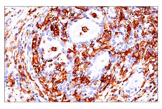 Immunohistochemistry Image 4: LAIR-1 (E7X6I) XP<sup>®</sup> Rabbit mAb (BSA and Azide Free)