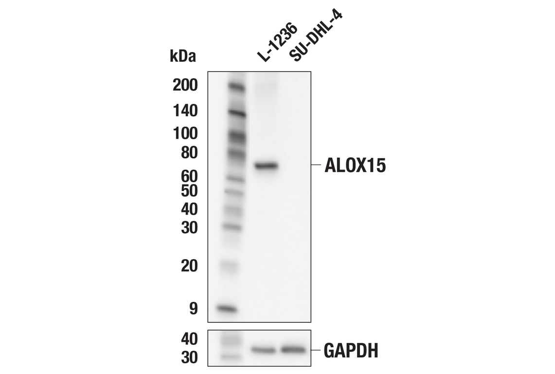 Western Blotting Image 2: ALOX15 (E5D1C) Rabbit mAb