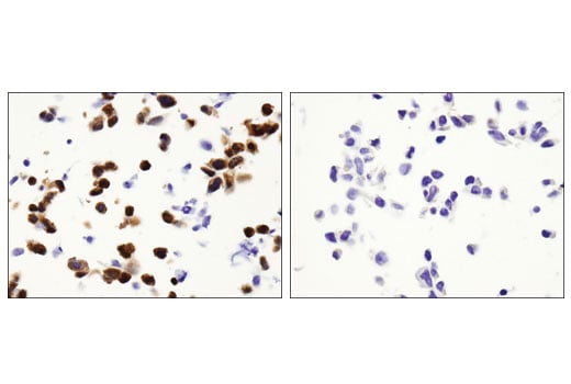 Immunohistochemistry Image 4: Akt1 (D9R8K) Rabbit mAb