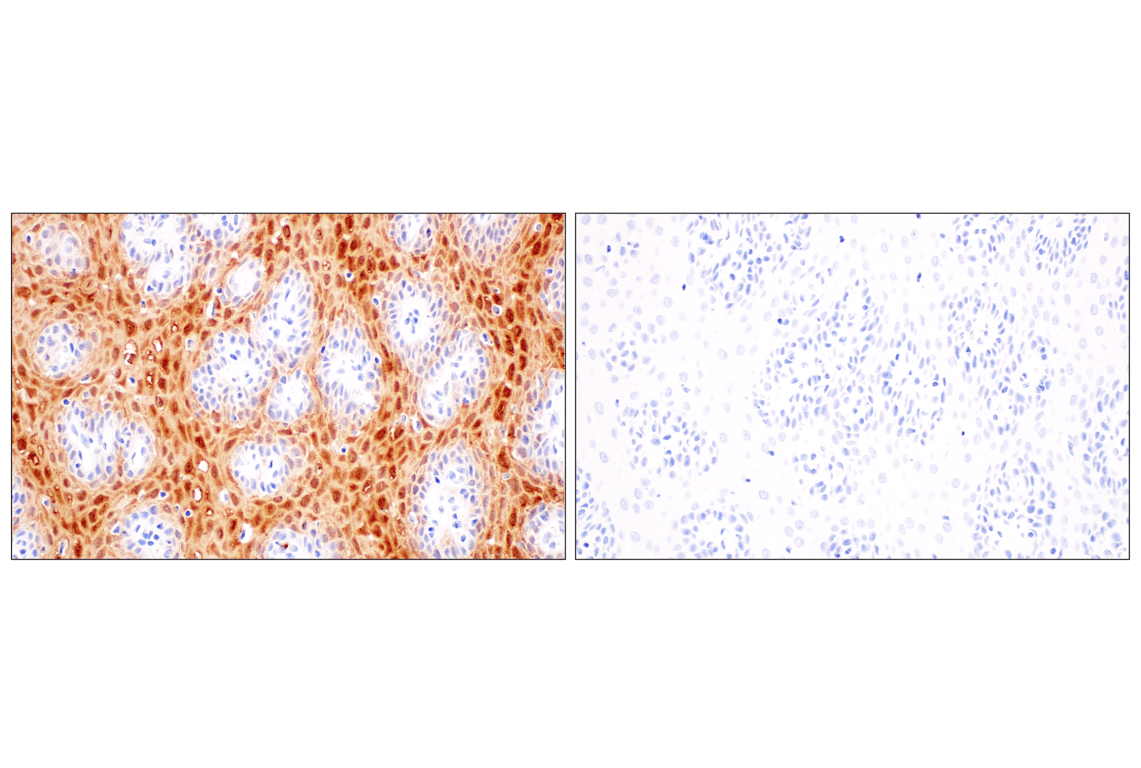 Immunohistochemistry Image 11: S100A8 (F4R2W) Rabbit mAb (BSA and Azide Free)