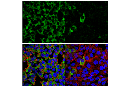 Immunofluorescence Image 1: YTHDF2 (E2I2H) Rabbit mAb