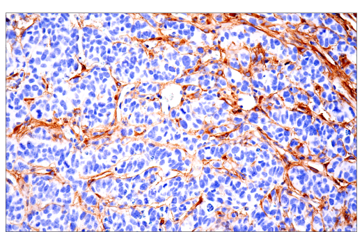 Immunohistochemistry Image 6: COL1A1 (E8F4L) XP<sup>®</sup> Rabbit mAb (BSA and Azide Free)