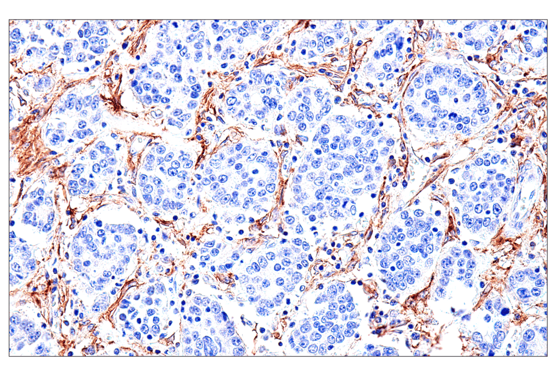 Immunohistochemistry Image 2: FAP (F1A4G) Rabbit mAb