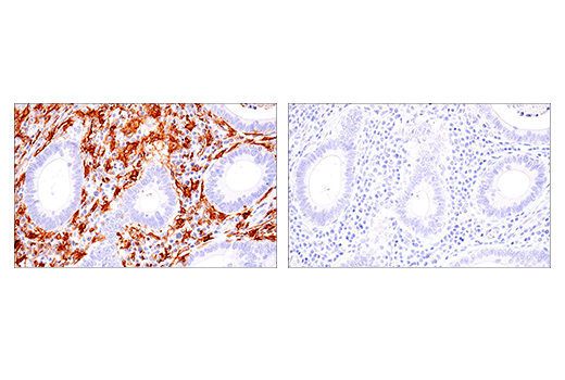 Immunohistochemistry Image 5: LAIR-1 (E7X6I) XP<sup>®</sup> Rabbit mAb (BSA and Azide Free)