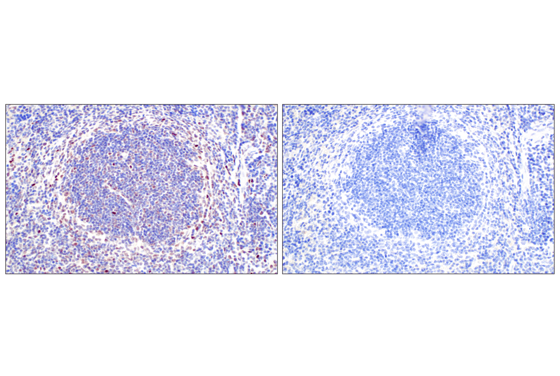 Immunohistochemistry Image 9: TCF4/ITF2 (E3X2Y) Rabbit mAb