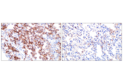 Immunohistochemistry Image 6: SARS-CoV-2 Nucleocapsid Protein (E8R1L) Mouse mAb