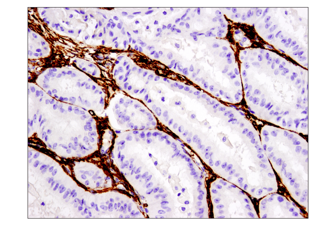 Immunohistochemistry Image 1: α-Smooth Muscle Actin (D4K9N) XP<sup>®</sup> Rabbit mAb (BSA and Azide Free)
