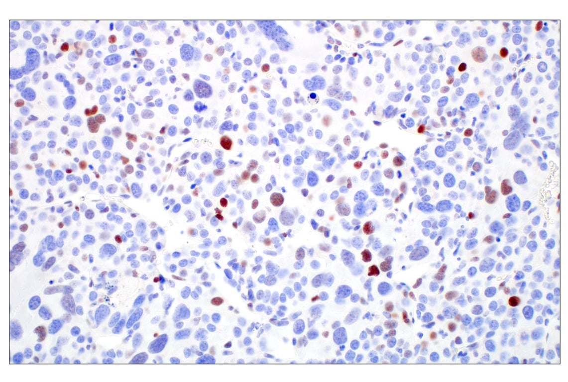 Immunohistochemistry Image 8: c-Fos (E2I7R) XP<sup>®</sup> Rabbit mAb