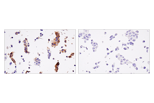 Immunohistochemistry Image 1: HLA-G (E8N9C) XP<sup>®</sup> Rabbit mAb