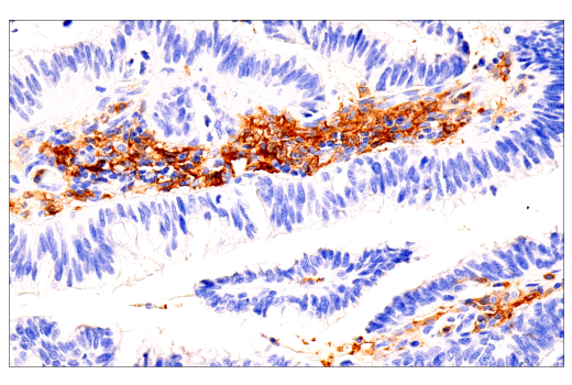 Immunohistochemistry Image 2: GM-CSF Receptor α (E8Z3S) Rabbit mAb